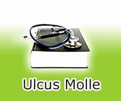 Medizinlexikon: Ulcus Molle