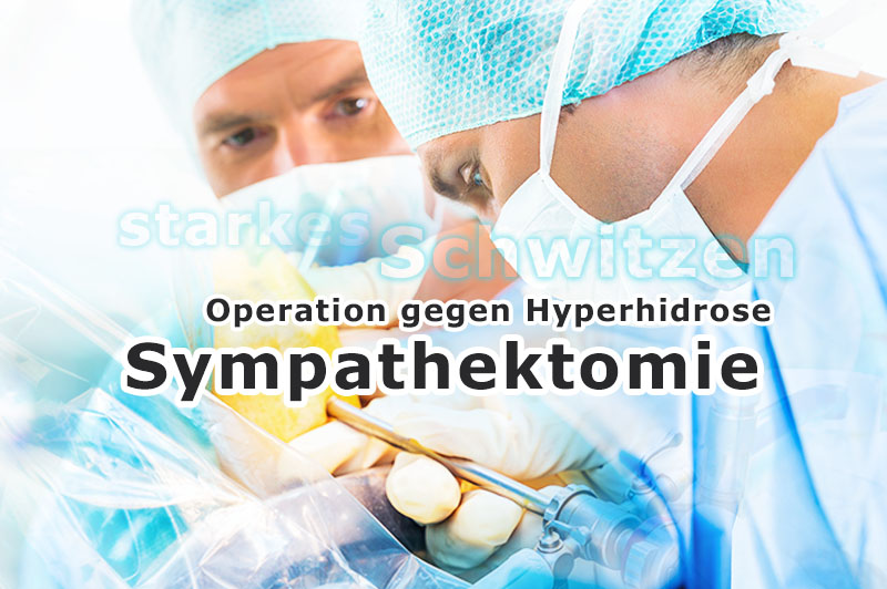 Sympathektomie: Operation bei übermäßigem Schwitzen