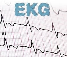 Was Ist Ein EKG | Elektrokardiogramm ? › Gesund.co.at