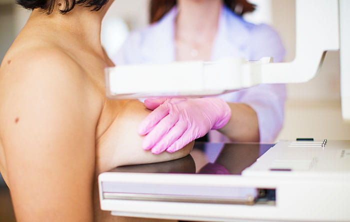 Ablauf einer Mamographie