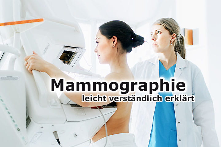 Mammographie zur Früherkennung von Brusterkrankungen