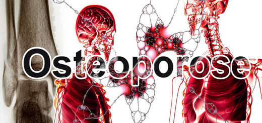 Osteoporose | Krankheitslexikon