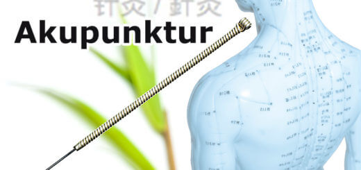 Akupunktur: feine Nadeln, starke Wirkung