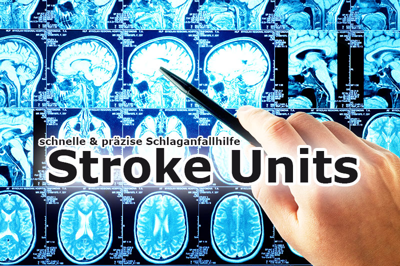 Schlaganfall: präzise Diagnose in Stroke Units