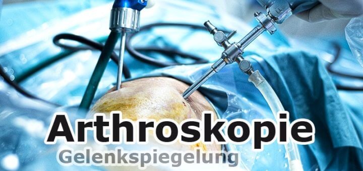 Arthroskopie - Gelenkspiegelung | Medizinlexikon