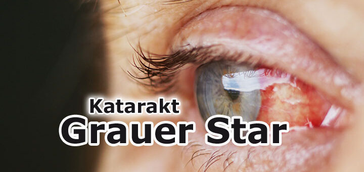 Grauer Star (Katarakt) – Ursachen, Symptome und moderne Behandlung