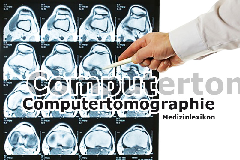 Computertomographie | Medizinlexikon