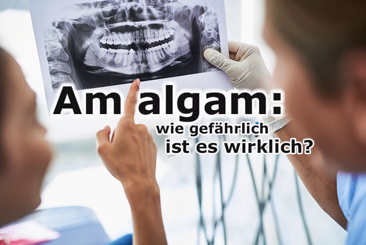 Amalgam: Wie gefährlich ist es wirklich?