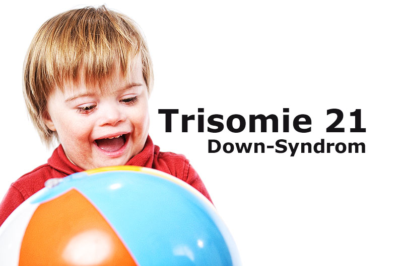 Kind mit Trisomie 21 bzw. Down Syndrom