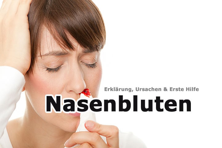 Nasenbluten (Epistaxis)