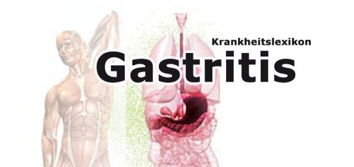 Gastritis (Magenschleimhautentzündung) | Krankheitslexikon