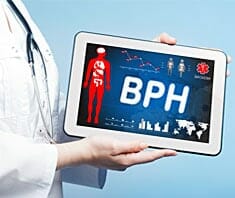 Benigne Prostatahyperplasie (BPH)