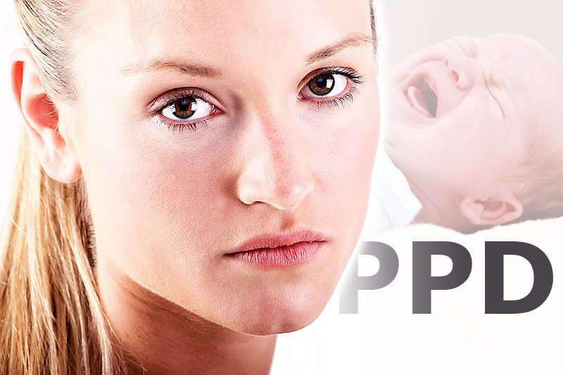 Frau mit Postpartaler Depression | PPD
