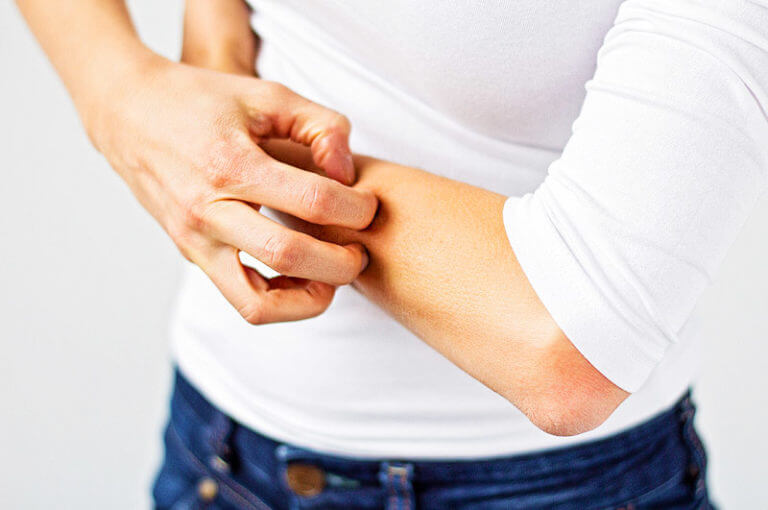Was tun bei Juckreiz? Ursachen und Tipps für Betroffene » gesund.co.at