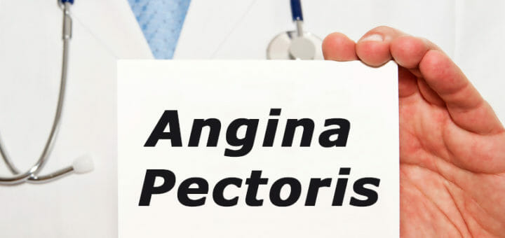 Angina Pectoris - Ursachen, Symptome und Behandlung