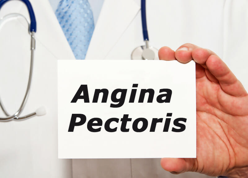 Angina Pectoris - Medizinisches Wörterbuch
