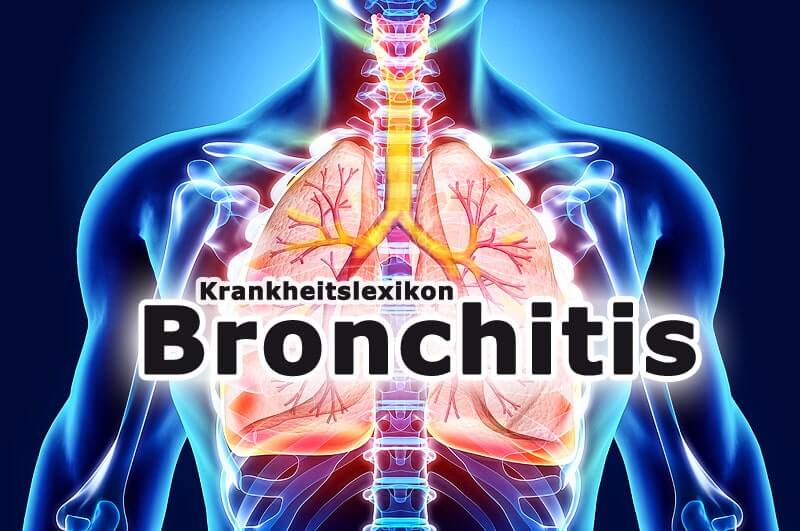 Bronchitis | Krankheitslexikon