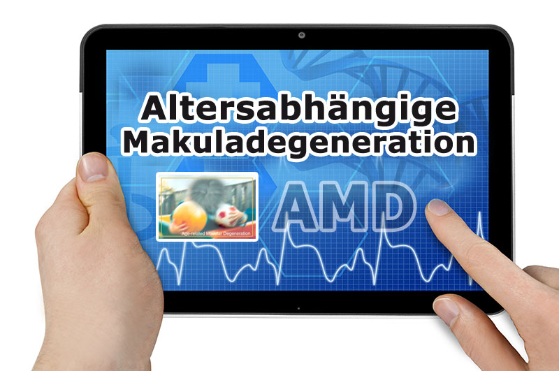 Altersabhängige Makuladegeneration (AMD)