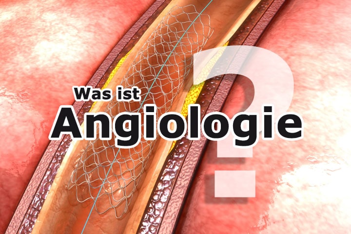 Was ist Angiologie?