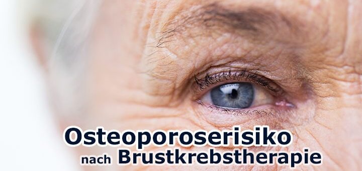 Erhöhtes Osteoporose-Risiko nach Brustkrebstherapie