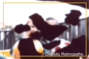 Diabetische Retinopathie